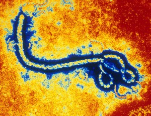 Ebola Zaire Virus (TEM). Photography. Encyclopædia Britannica ImageQuest. Web. 4 Dec 2014. http://quest.eb.com/#/search/139_1923846/1/139_1923846/cite